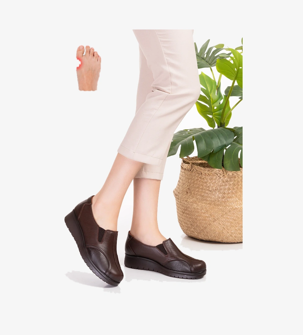 Gondol Hakiki Deri Kadın Kemik Çıkıntısına Özel Ayakkabı elnr.5778